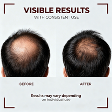 Capixy Hair Fertilizer Tonic Spray 250ml Hair Growth & Scalp Care Spray